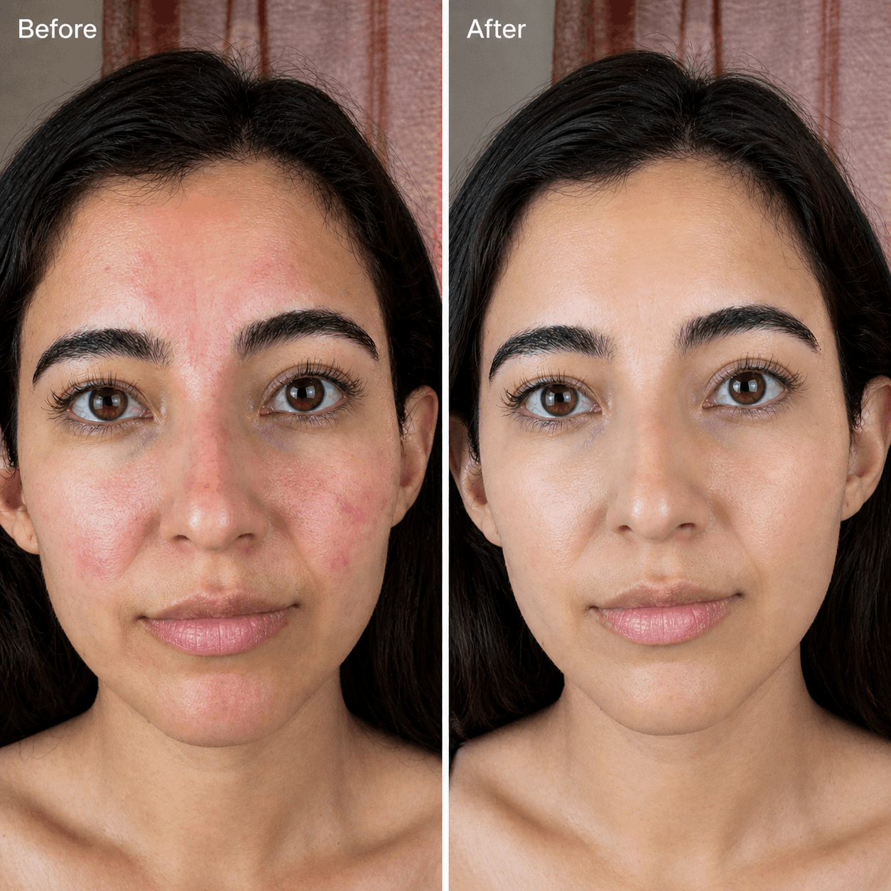 Velino LUMEX Photon Pro — black LED face mask with red light therapy glow worn by a woman, including neck therapy device