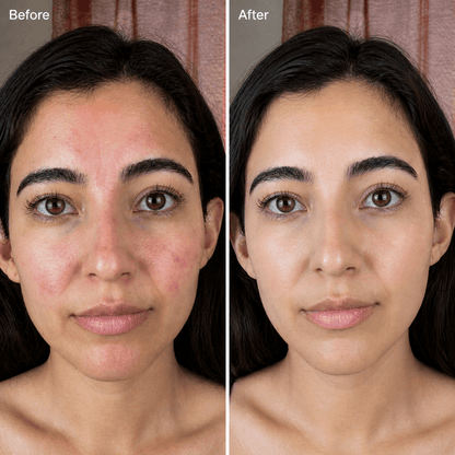 Velino LUMEX Photon Pro — black LED face mask with red light therapy glow worn by a woman, including neck therapy device